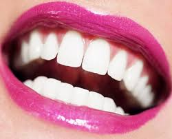 Răng giả có tẩy trắng được không