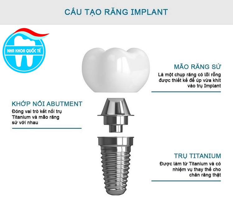 cấu tạo răng implant